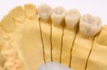 /album/photo-gallery-pictures/a1306126100-206350104-8-nyexpress-dental-lab-jpg/